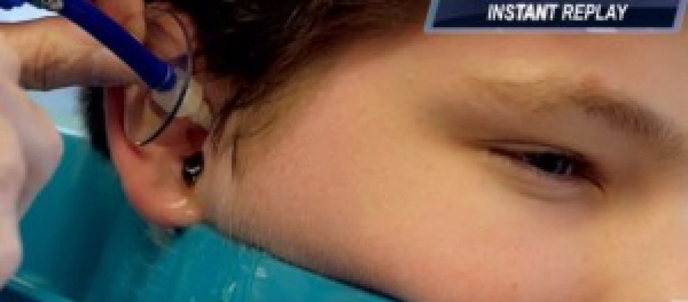 Ο γιατρός εξετάζει το αυτί του μικρού όταν ξαφνικά… δείτε τι βγαίνει από μέσα!